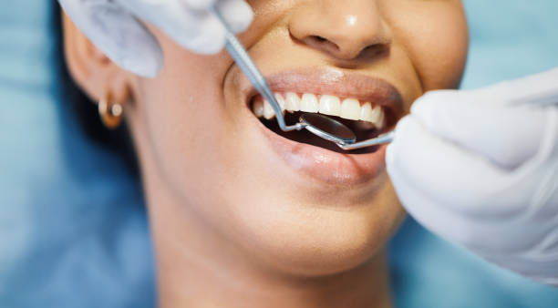 Best Emergency Dentist for Knocked-Out Tooth in Fort Lauderdale, FL